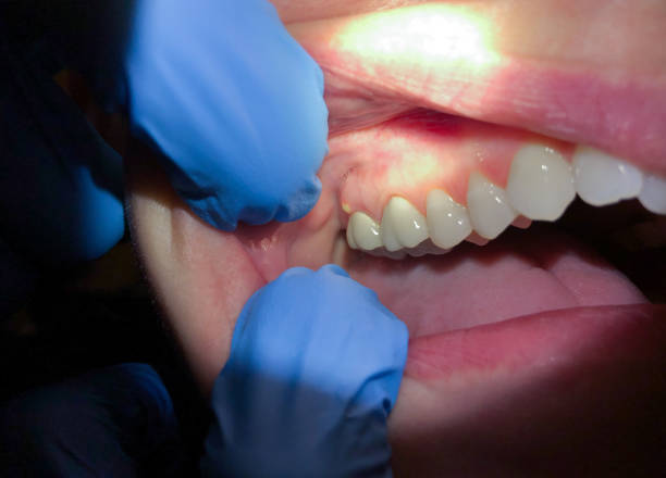 Best Emergency Dental Care for Sports Injuries in Morton, TX