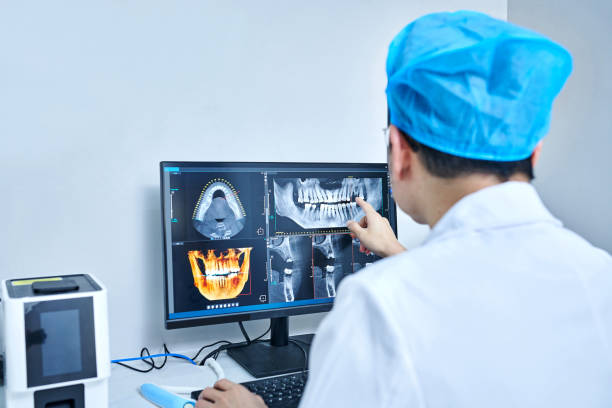 Best Knocked-Out Tooth (Avulsed Tooth) Treatment in Morton, TX